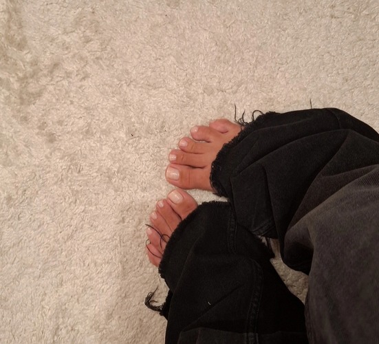 How to Remove Cracked Heels at Home: 5 Simple and Effective Steps